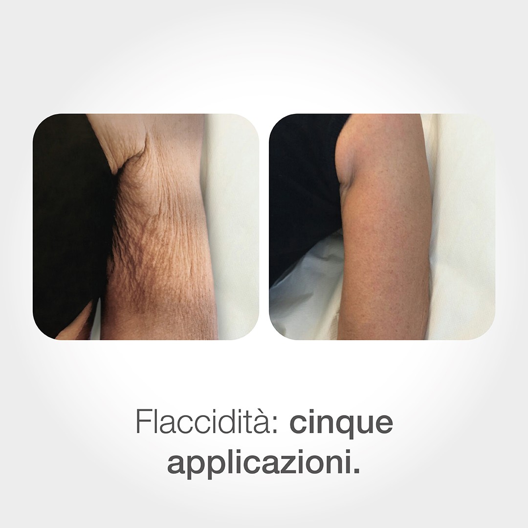 trattamento estetici