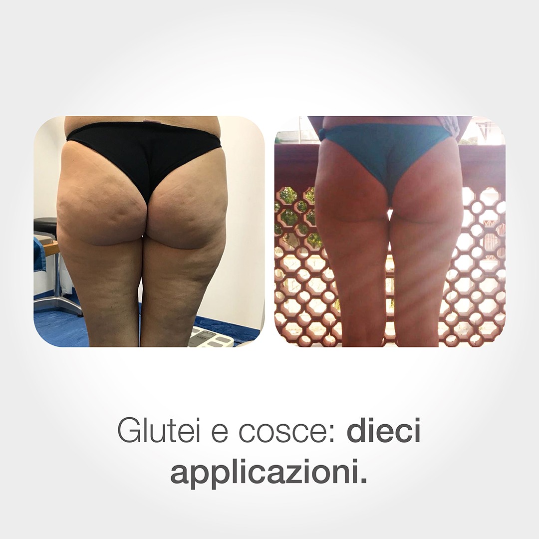 trattamento estetici